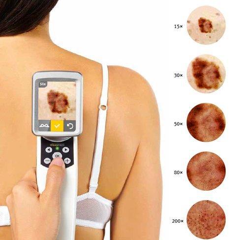 Advanced Skin Assessment