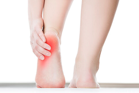 Plantar Fasciitis